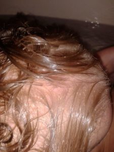 Looking for a natural cradle cap remedy? The solution is closer and easier than you think. Infants and toddlers can have a clear scalp. Coconut oil is one natural remedy - learn all 3! Learn how to get rid of cradle cap on your baby today! @naturalsoapmom.com #cradlecap #naturalbaby #babyskinproblems #haircare #coconutoil #bakingsoda #cradlecapshampoo #Babycare #Newborn #Naturalskincare #Cradlecap #Babies #Babyskin 