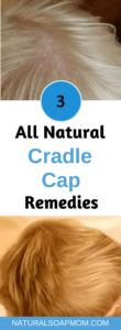 Looking for a natural cradle cap remedy? The solution is closer and easier than you think. Infants and toddlers can have a clear scalp. Coconut oil is one natural remedy - learn all 3! Learn how to get rid of cradle cap on your baby today! @naturalsoapmom.com #cradlecap #naturalbaby #babyskinproblems #haircare #coconutoil #bakingsoda #cradlecapshampoo #Babycare #Newborn #Naturalskincare #Cradlecap #Babies #Babyskin 
