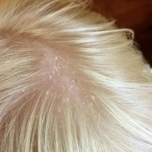 Looking for a natural cradle cap remedy? The solution is closer and easier than you think. Infants and toddlers can have a clear scalp. Coconut oil is one natural remedy - learn all 3! Learn how to get rid of cradle cap on your baby today! @naturalsoapmom.com #cradlecap #naturalbaby #babyskinproblems #haircare #coconutoil #bakingsoda #cradlecapshampoo #Babycare #Newborn #Naturalskincare #Cradlecap #Babies #Babyskin 
